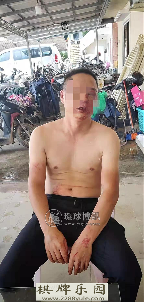 一名中国小伙在西港某赌场门口遭保安围殴